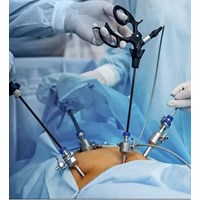 گاز دی اکسید کربن