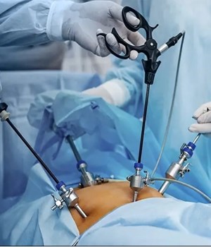 گاز دی اکسید کربن